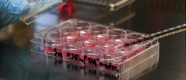 Reasons Why Stem Cell Collection Is Vital in Cancer Treatment